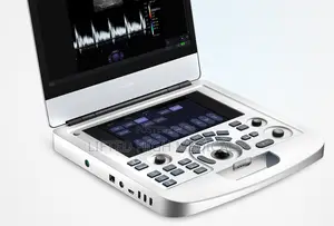 Edan Acclarix Ax3 Portable Color Doppler Ultrasound