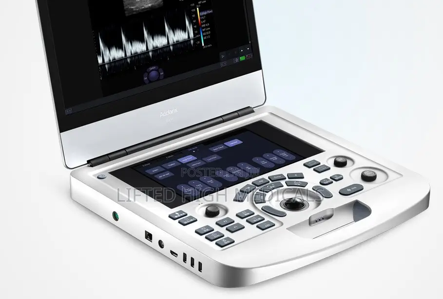 Edan Acclarix Ax3 Portable Color Doppler Ultrasound