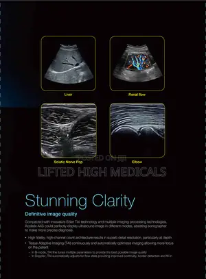 Edan Acclarix Ax3 Portable Color Doppler Ultrasound