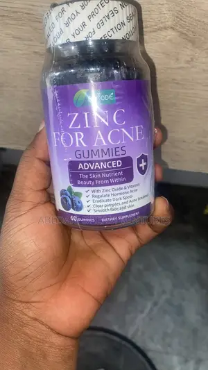 Acne and Pimples