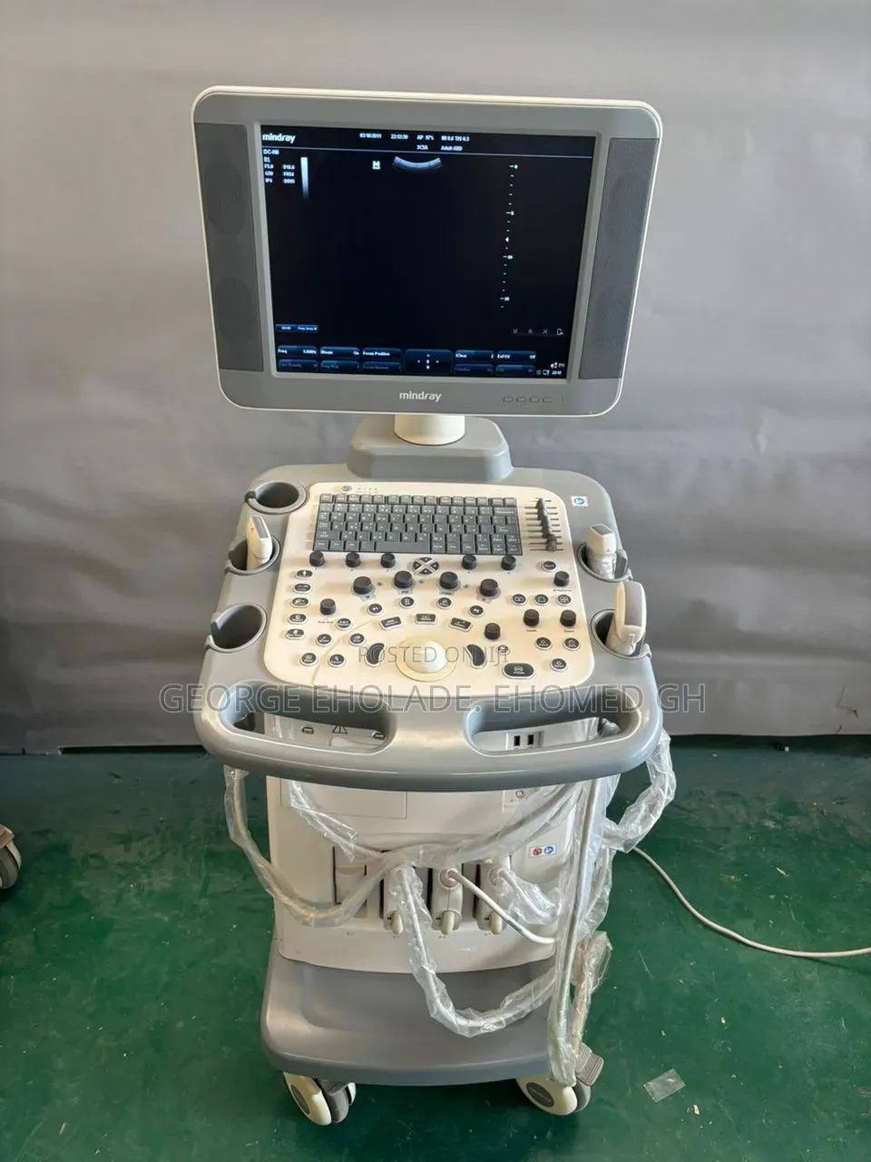 Ultrasound Mindray