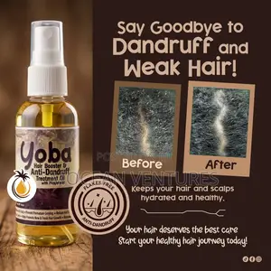 Yoba Hair Booster Dandruff Treatment Cream Oil