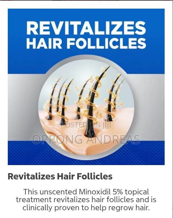 6 in 1 Kirkland Minoxidil 5% Extra Strength Hair Regrowth Solution