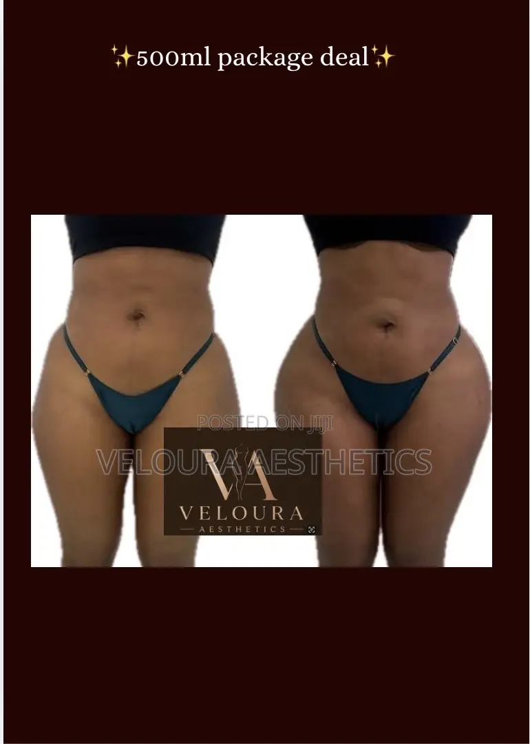 Non-Surgical BBL Fillers | Hip Dip Enhancement | Accra