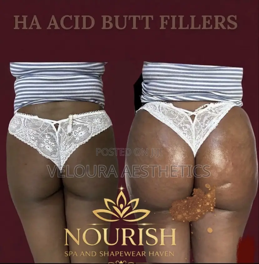Non-Surgical BBL Fillers | Hip Dip Enhancement | Accra