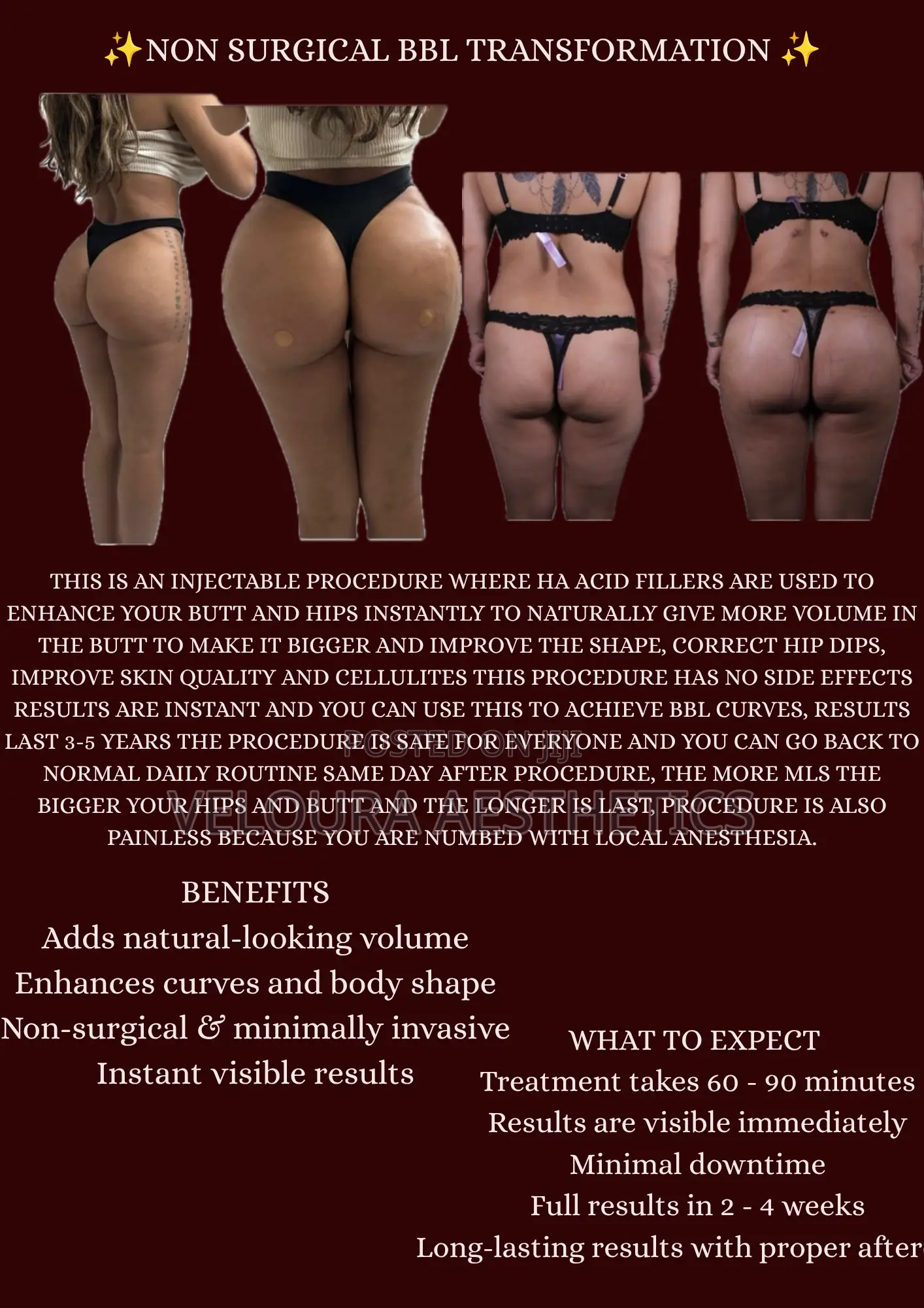 Non-Surgical BBL Fillers | Hip Dip Enhancement | Accra