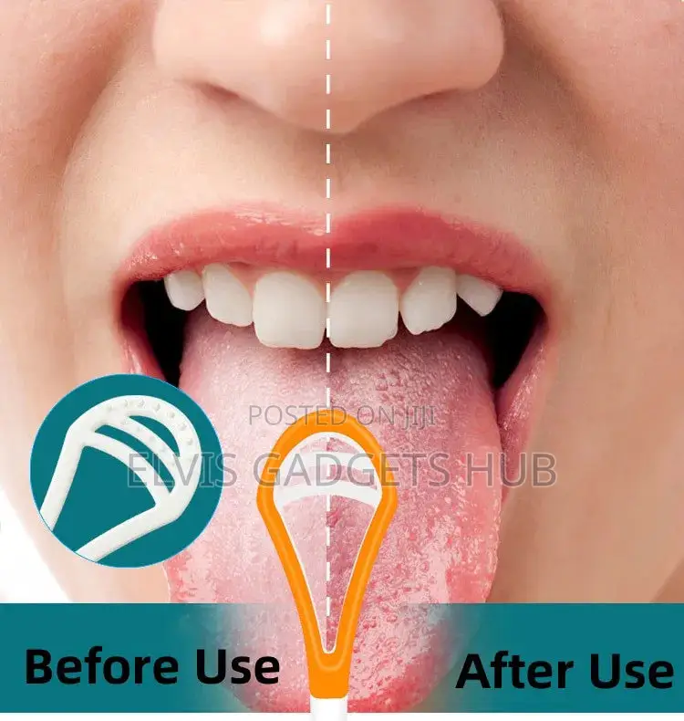 Tongue Scraper