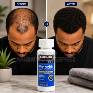 Buy Original Kirkland Minoxidil in Ghana