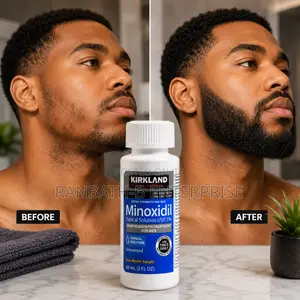 Original Kirkland Minoxidil – Quality You Can Trust