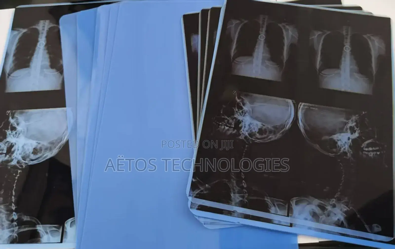 X-Ray Film