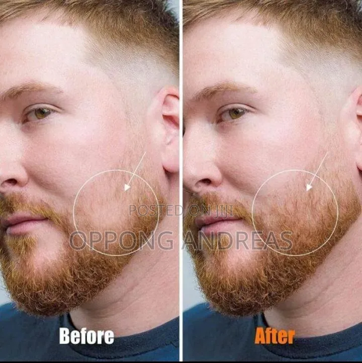 Original Dermatologist-Approved Kirkland Minoxidil Bottle 6ml