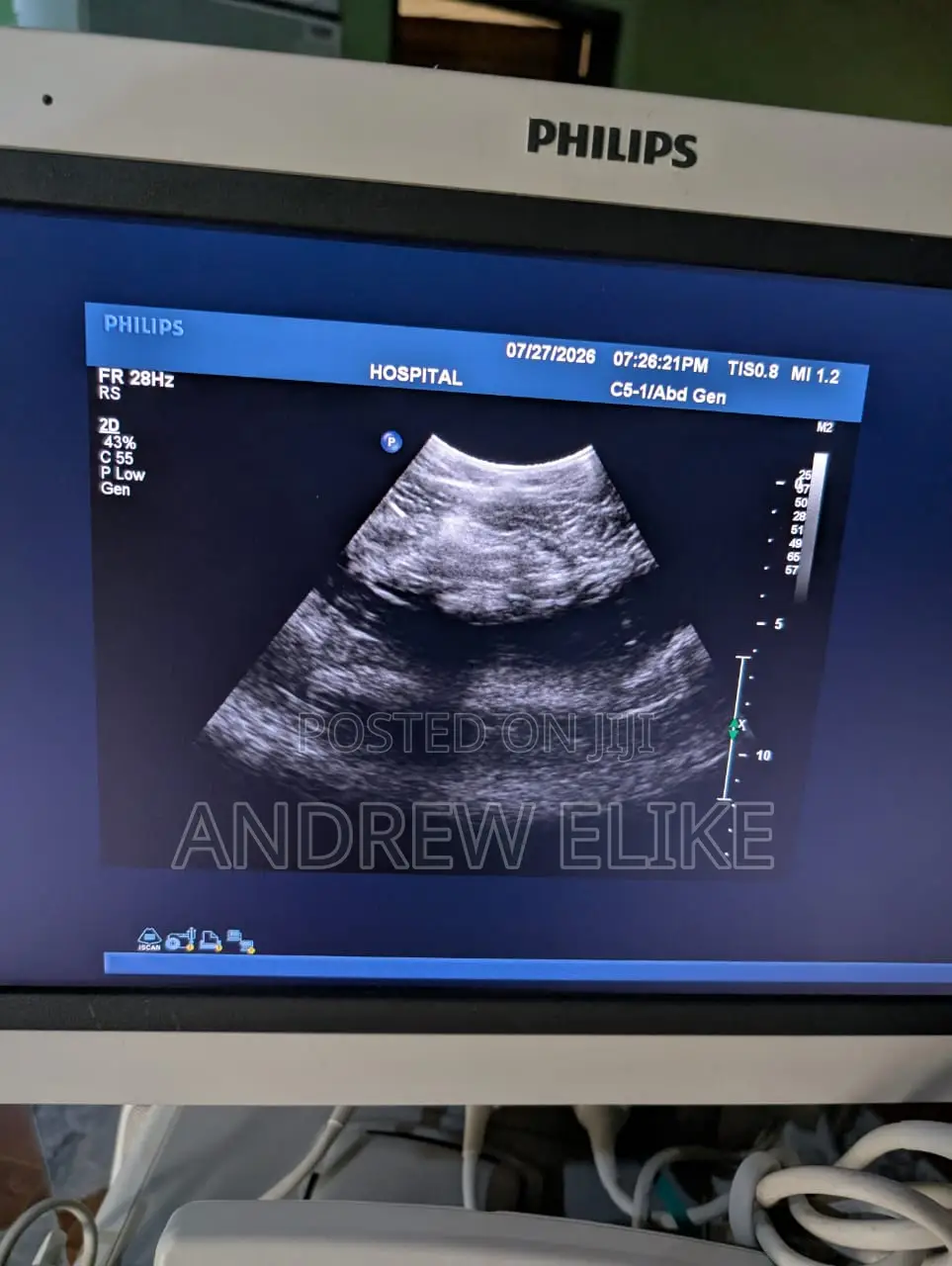 Philips Ultrasound Machine