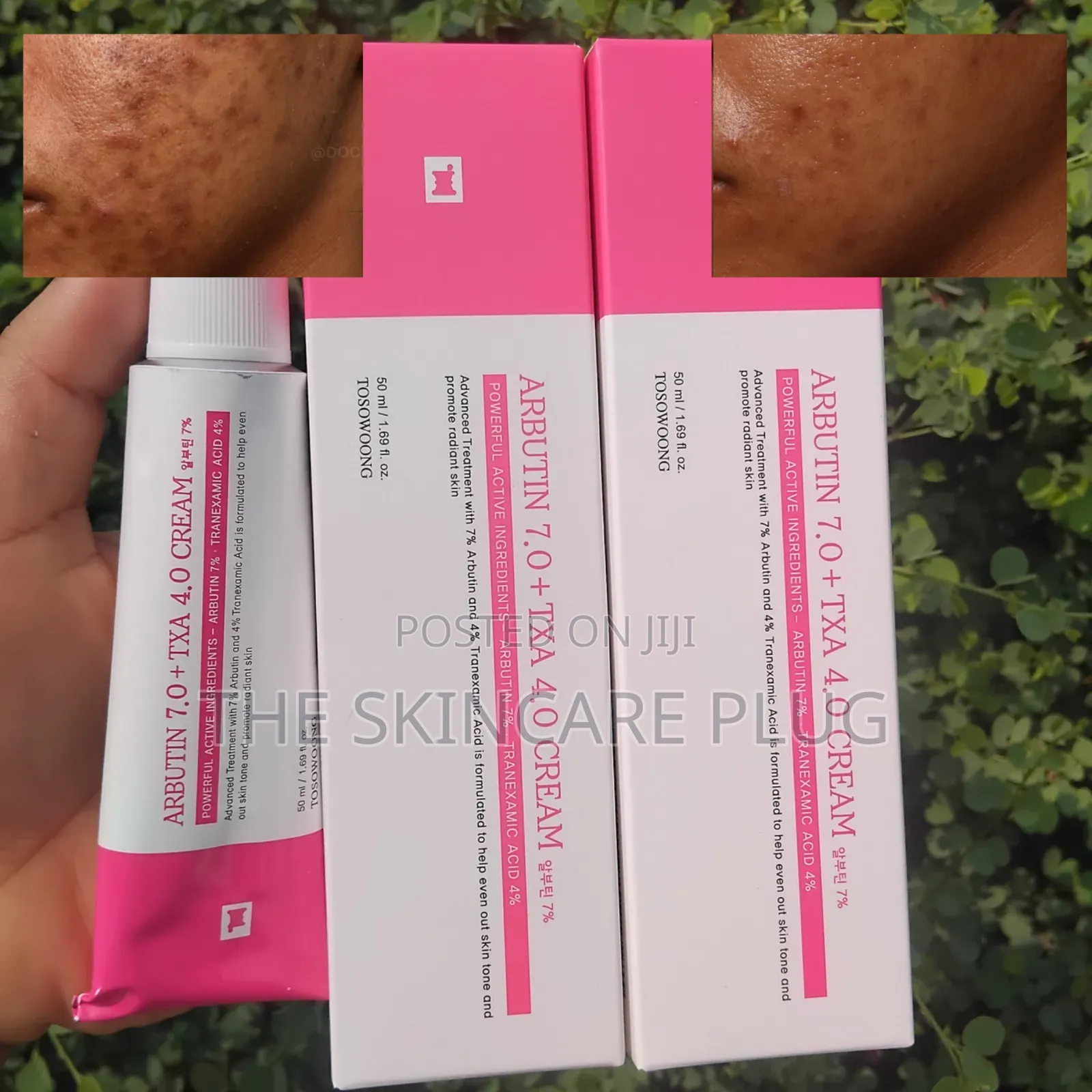 Tosowoong Arbutin 7.0 + TXA 4.0 Cream
