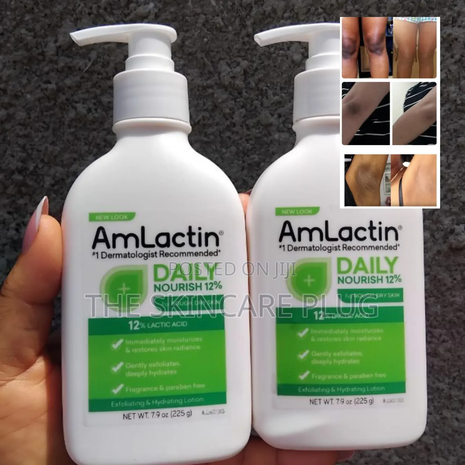 Amlactin Nourishing Body Lotion With 12% Lactic Acid